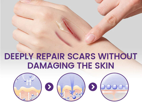 Timilk ReGenScar Stem Cell Scar Gel